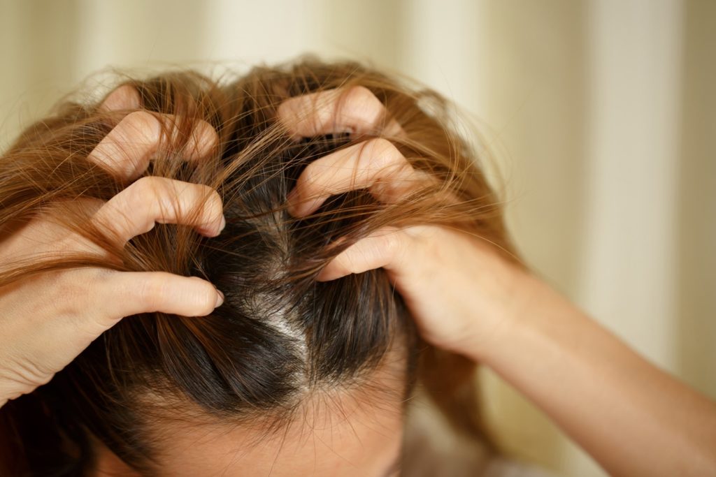 Hairfall in Winter  Causes  4 Ways to Stop Hairfall in Winters