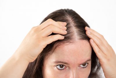 Love And Hate Relationship Between Stress And Hair Loss - Advance Clinic