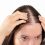 Ending the Stigma Surrounding Female Hair Loss