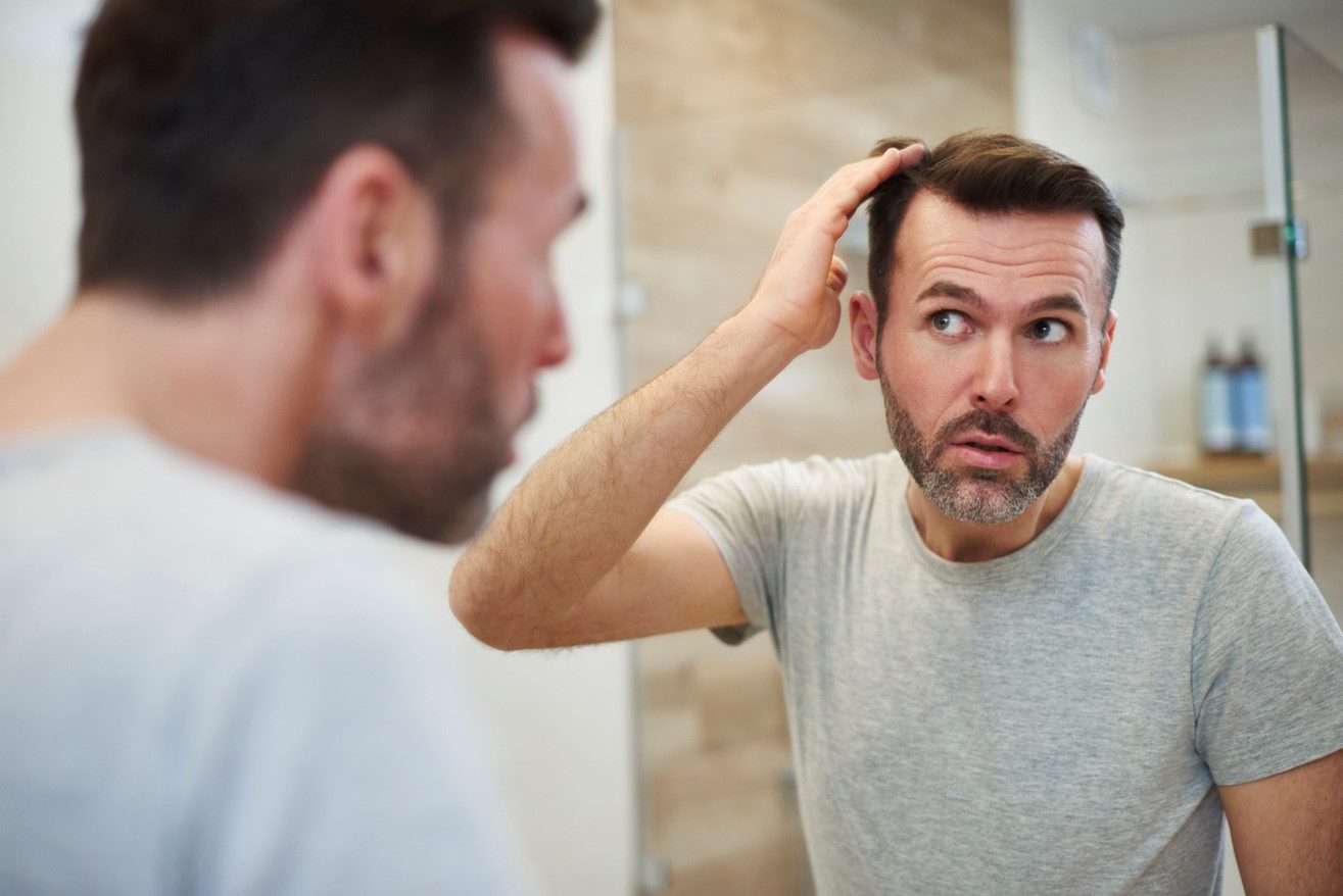Hair Thickening Strategies for Men - Hair Transplants & Hair Loss  Restoration in CT, MA, RI & NH