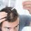 Tips to Avoid Hair Restoration Scams